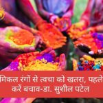 केमिकल रंगों से त्वचा को खतरा, पहले से करें बचाव-डा. सुशील पटेल 